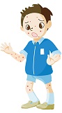 アレルギー発症児童イラスト 発疹