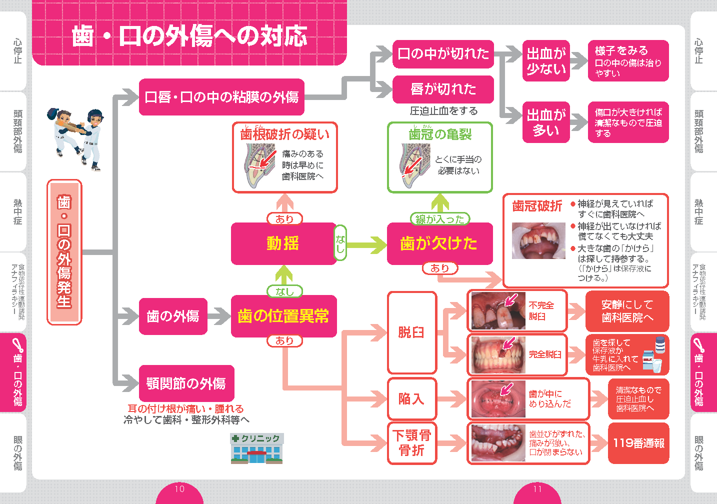 歯・口の外傷対応フロー