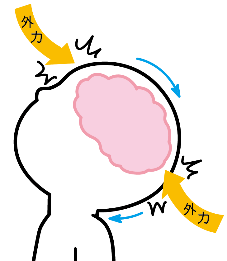 脳に外力が加わる図